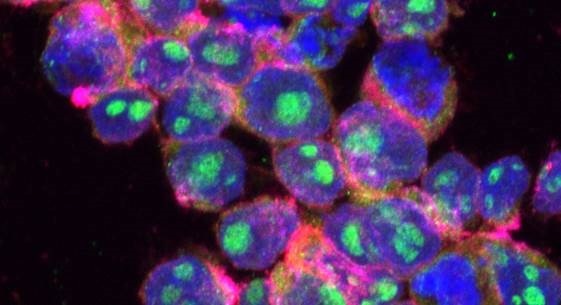 Desarrollan Nanocápsulas Con Control Remoto Para Amplificar Localmente El Efecto De La Quimioterapia