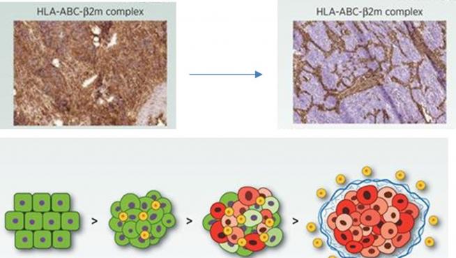 Demuestran El Papel De Unas Proteinas Para Ayudar Al Sistema Inmune A Detectar El Cancer